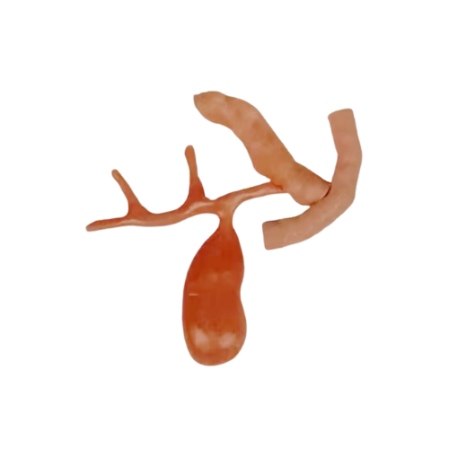 胆囊胰腺肠管模型套装.png