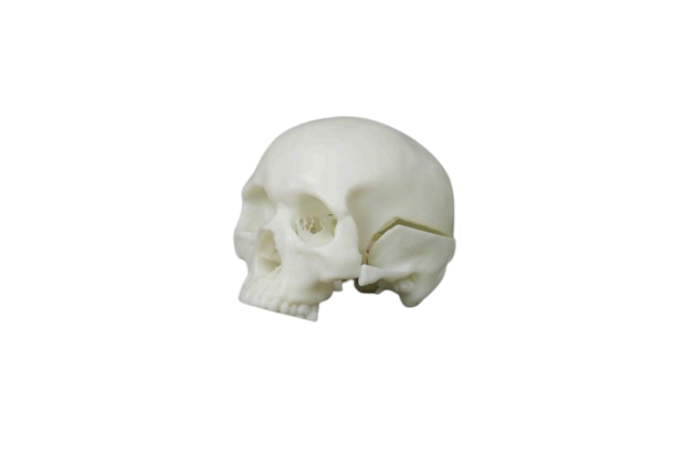 3D-Printed Temporal Bone Surgery Simulation Training Model.png