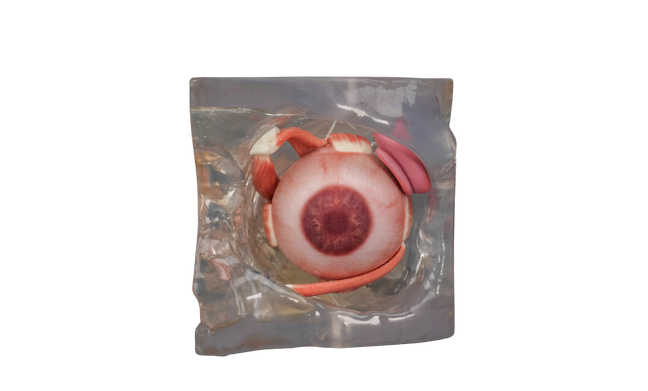 3D-Printed Ocular Surgery Simulation Training Model.png